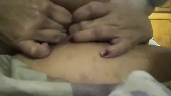 Fisting anal, pussy fist, prolapso anal, pussy prolapse