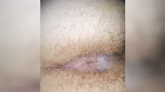 Anal gape with tools. Obgyn speculum inspection.