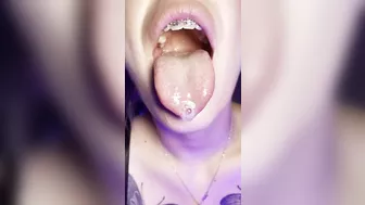 Gag reflex. Drooling and gagging by metal mouth