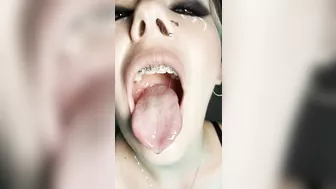 Gag reflex. Drooling and gagging by metal mouth