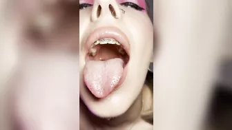 Mouth teasing. Sloppy girl with braces