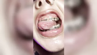 Mouth teasing. Sloppy girl with braces