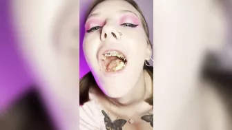 Food crush. Girl with braces chewing food