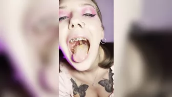 Food crush. Girl with braces chewing food