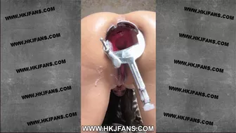 Hotkinkyjo in white bra open her ass with XO speculum, self anal fisting & prolapse