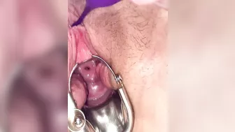 First time cervix play pee hole teasing with speculum