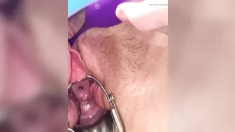 First time cervix play pee hole teasing with speculum