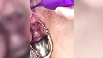 First time cervix play pee hole teasing with speculum