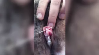 Clitoris needle piercing