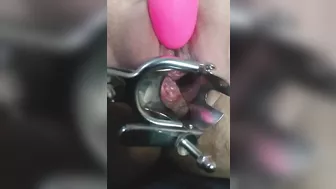 close up speculum and internal veiw of squirting