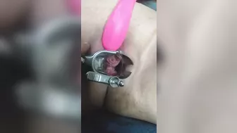 close up speculum and internal veiw of squirting