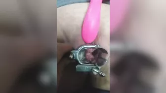 close up speculum and internal veiw of squirting