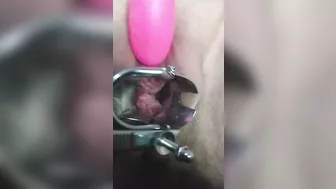 close up speculum and internal veiw of squirting