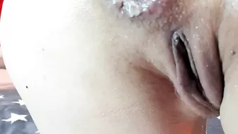 anal gaping after fisting