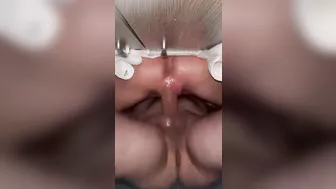 Bottom view squirting orgasm.