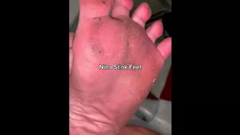 Really Dirty and Stinky Feet! Clean it now.