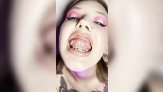 Metal mouth tour. Schoolgirl with braces showing her uvula