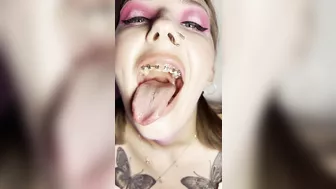 Metal mouth tour. Schoolgirl with braces showing her uvula