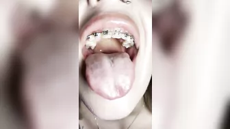 Metal mouth tour. Schoolgirl with braces showing her uvula