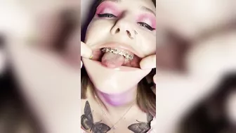 Metal mouth tour. Schoolgirl with braces showing her uvula