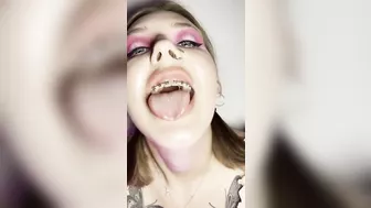 Metal mouth tour. Schoolgirl with braces showing her uvula