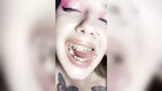 Metal mouth tour. Schoolgirl with braces showing her uvula