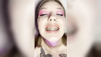 Metal mouth tour. Schoolgirl with braces showing her uvula